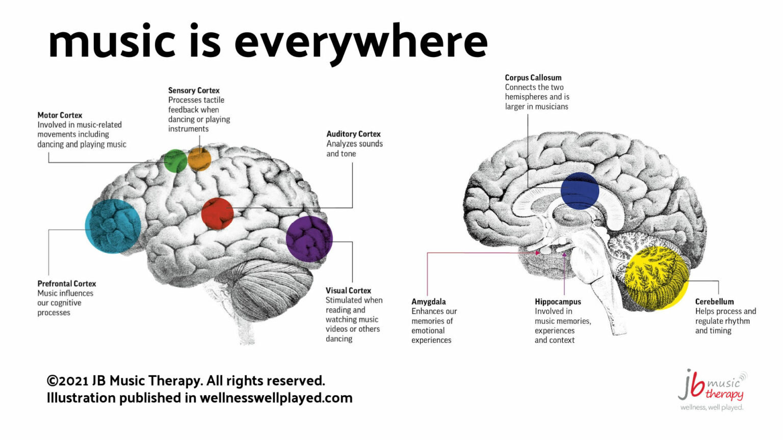 How the Brain Processes Music - JB Music Therapy